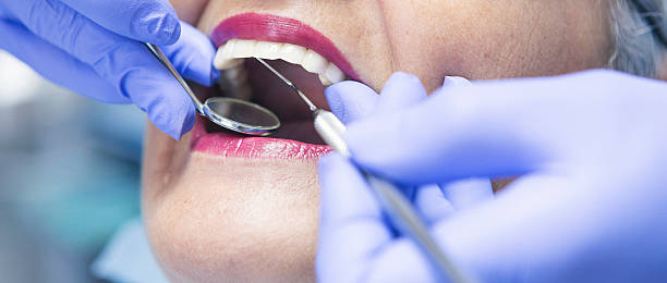 Best Emergency Broken Tooth Repair in Dillon, SC